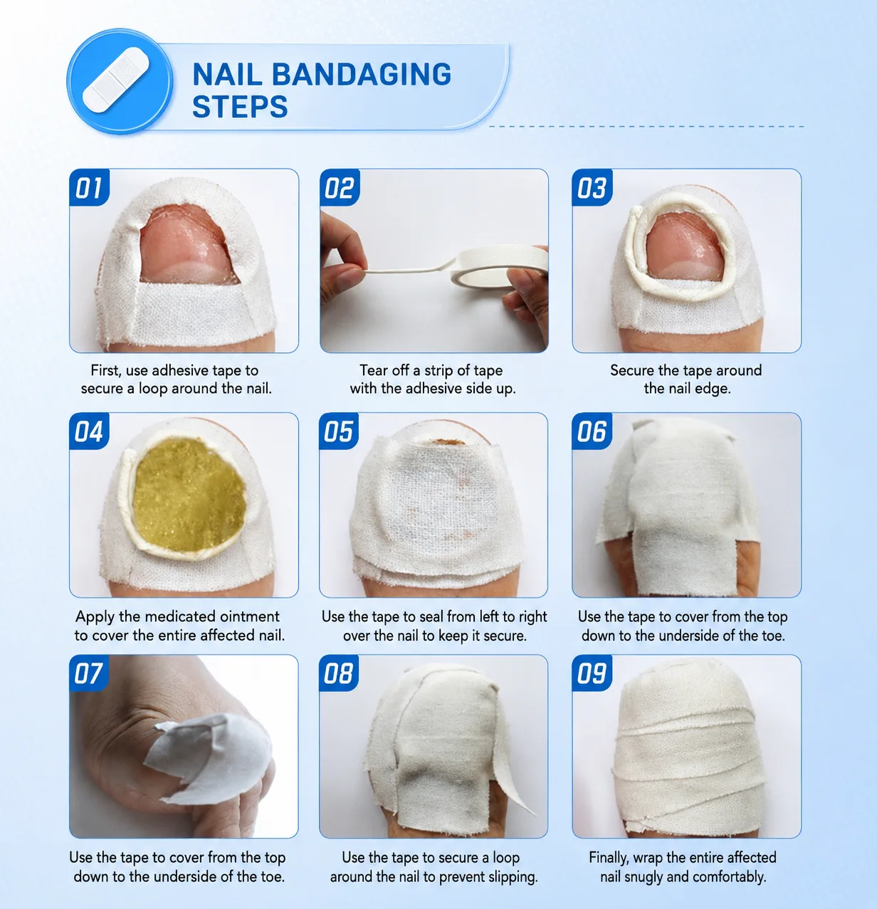 Nail bandaging steps — detailed wrapping guide for the herbal cream